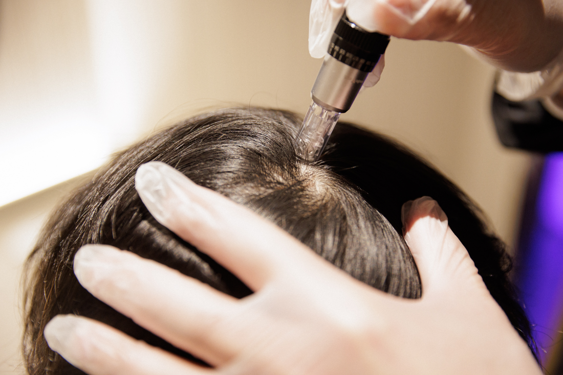 Everything You Need to Know About Our New Hair Growth Treatment